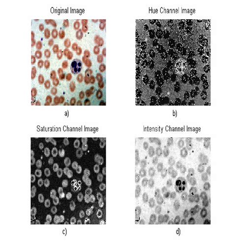 Automatic White Blood Cell Differential Classification Semantic Scholar