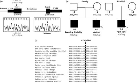 Whole Exome Sequencing Identifies A Novel Heterozygous Misse