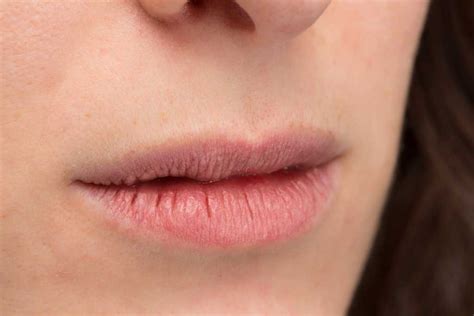 Segera cari tahu penyebab dan cara menghilangkan stres yang paling tepat. 15 Cara Mengatasi Bibir Kering (Mudah dan Efektif) - Masih ...