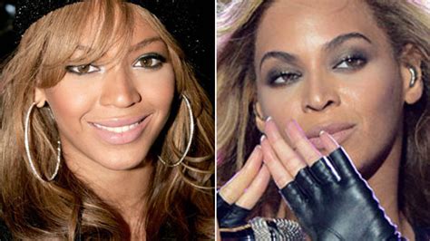 Beyonce Nose Job Rumors — Did She Go Under The Knife Experts Weigh In