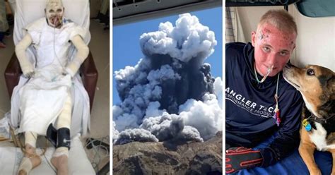 Young Man Who Survived Horrific Volcano Eruption Reveals Heroic Journey