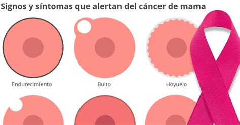 D A Contra El C Ncer De Mama Los Signos Externos Que Pueden Delatar Un Tumor En El Pecho