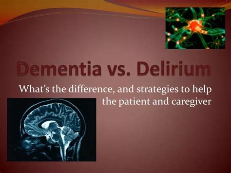 Ppt Dementia Vs Delirium Powerpoint Presentation Id1824119