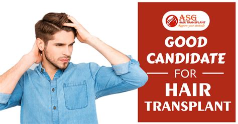 Factors Which Determine The Patient Is A Good Candidate For Hair Transplant