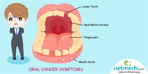 What Does The Early Signs Of Mouth Cancer Look Like Oral Head And