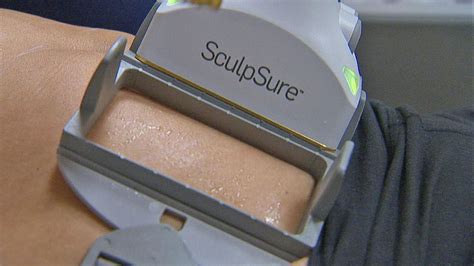 Sculpsure Can This Nonsurgical Procedure Melt Body Fat Abc News