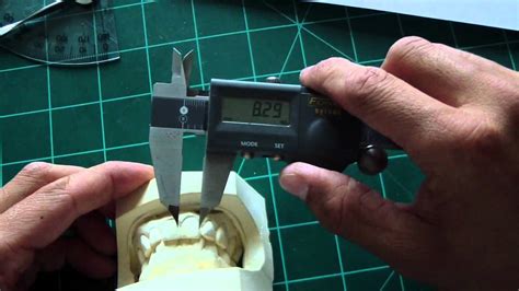 Boley Gauge Or Digital Calipers Measuring Teeth Youtube