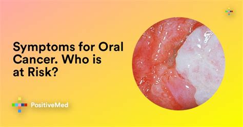 Symptoms For Oral Cancer Who Is At Risk Positivemed