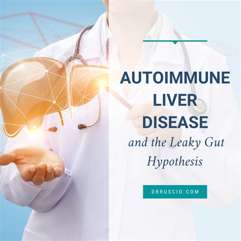 Gluten Sensitivity And Autoimmune Disease Dr Michael Ruscio Bcdnm Dc