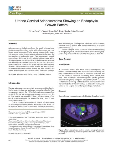Pdf Uterine Cervical Adenosarcoma Showing An Endophytic Growth Pattern