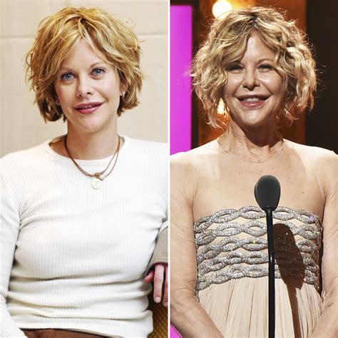 Meg Ryan Plastic Surgery Disaster Before And After Pi