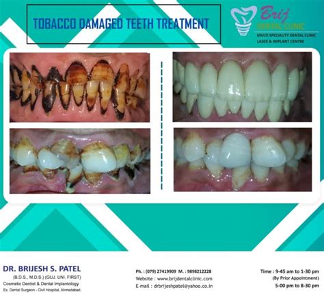 Advance Dentistry In Ahmedabad Best Infrastructure Dental Technology