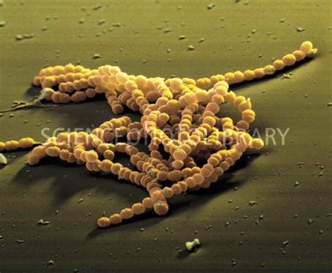 Streptococcus Agalactiae Bacteria Coloured Sem Streptococcus Agalactiae Scanning Electron