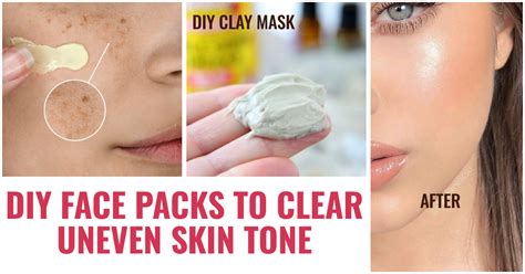 7 Diy Face Packs For Uneven Skin Tone