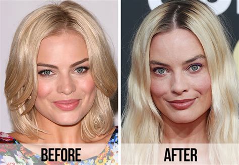 Fans Spot A Huge Difference In Margot Robbies Appearance After Looking At Before And After Photos