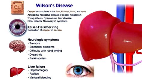 Wilsons Disease Skin