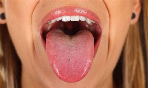 Covid Tongue What Is Covid Tongue Uk