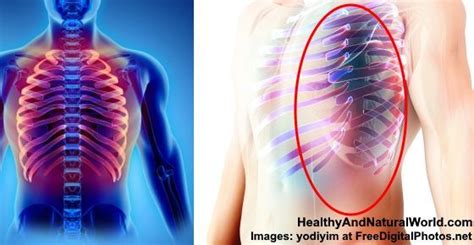 The thoracic cage, commonly called the rib cage, provides protection for the 2 lungs, heart, esophagus, diaphragm and liver. Säga Tvätta fönster flotte muscle pain under right rib ...