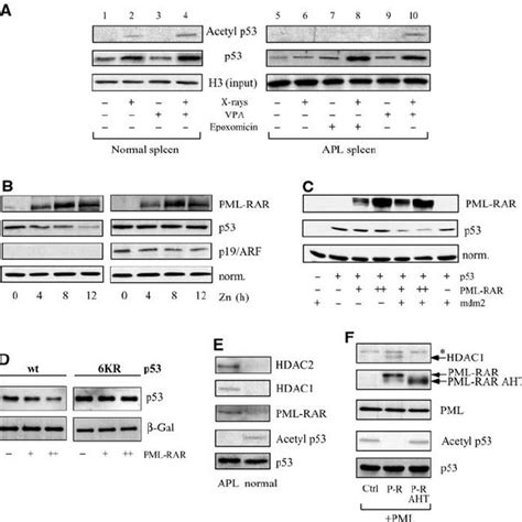 Pmlrar Acts As An Hdac Dependent Inhibitor Of Pathways Regulated By