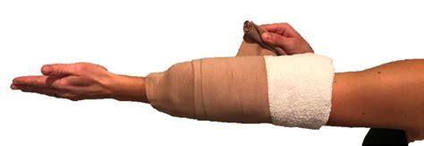 Cubital Tunnel Syndrome Raleigh Hand Surgery — Joseph J Schreiber Md
