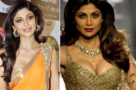 7 Bollywood Actresses Who Went For Breast Implants