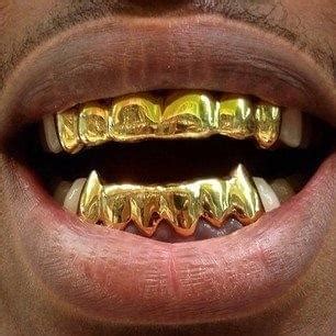Gold wire was used in dentistry in ancient times, and for filling cavities in the 19th century. Gold Teeth Grillz Facts - Everything you wanted to know ...