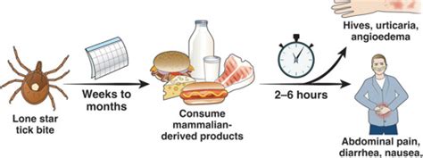 Understanding Mammalian Meat Allergy A Ticks Impact On Anaphylaxis