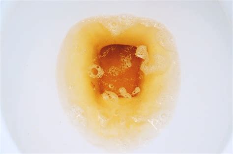 Closeup Urine Or Yellow Pee And Bubbles In White Flush Bowl Toilet
