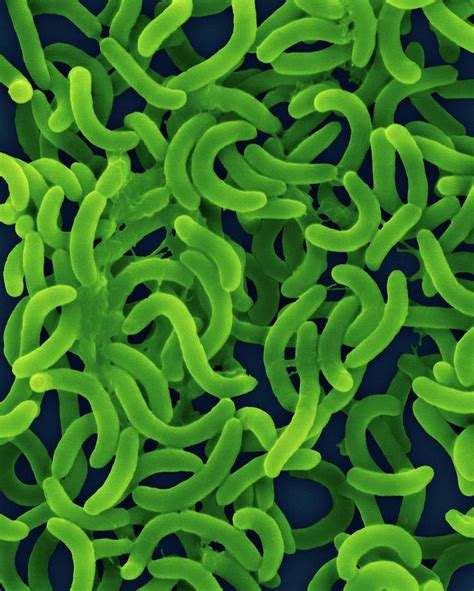 Vibrio Cholerae Bacteria Photograph By Dennis Kunkel Microscopyscience
