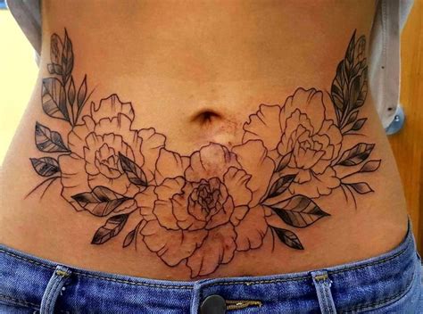 It is believed that this was the way of originating the art of japanese multicolor tattoo. Tummy Tuck Tattoo Cover Ups Pictures (41) | Cover tattoo ...