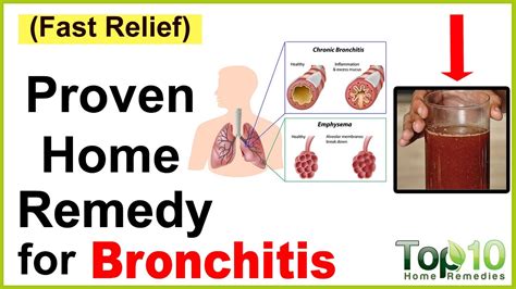 Best Medicine For Bronchitis