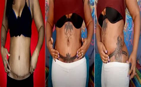 Aggregate More Than 68 Tummy Tuck Tattoo Cover Up Latest Thtantai2