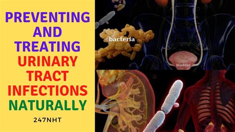Preventing And Treating Urinary Tract Infections Naturally