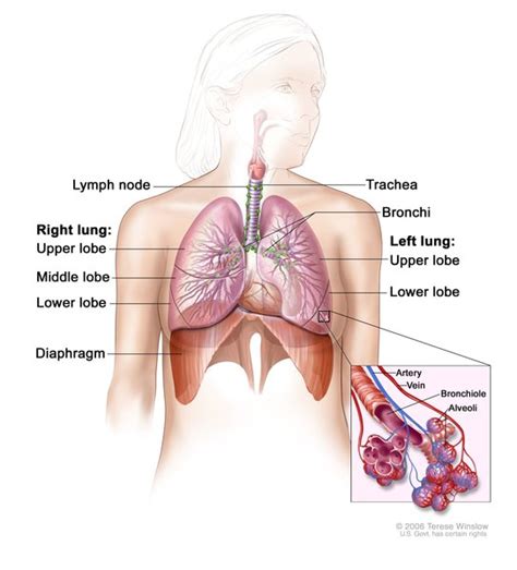 Lung Cancer MedlinePlus Genetics