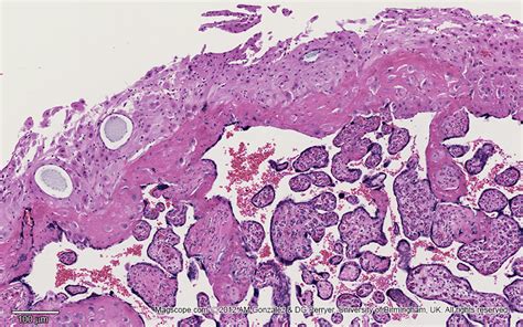 Placenta Histology Decidua