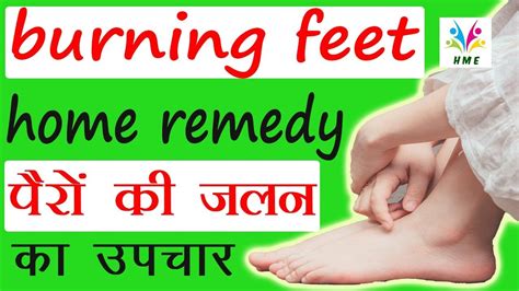 Burning Feet Home Remedy Best Home Remedy For Burning Sensation In