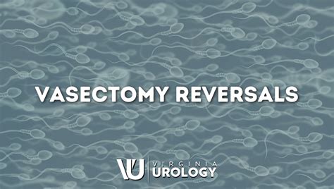 Vasectomy Reversals Virginia Urology