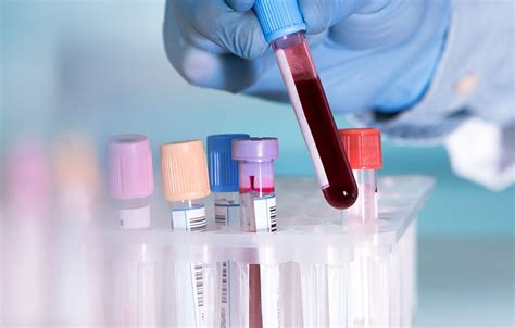 Blood Tests And Diagnosing Illness What Can Blood Tell Us About Whats