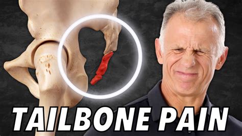 Top Self Treatments For Tailbone Coccyx Pain Or Coccydynia Youtube