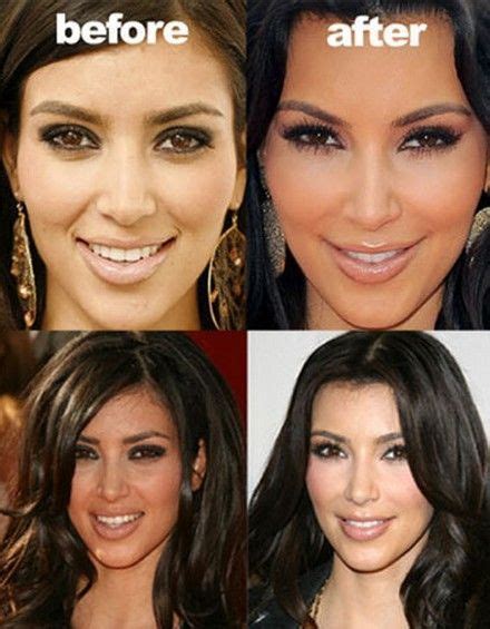 kim kardashian s face before and after plastic surgery i do not know what she … before and