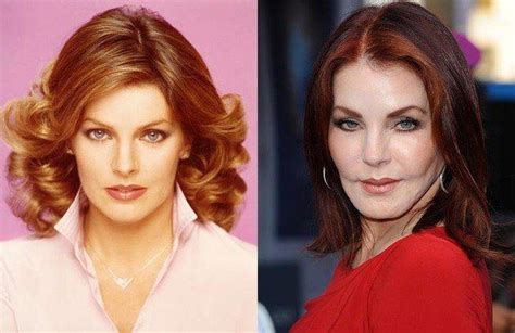 10 Before And After Celebrity Plastic Surgery Fails That ...