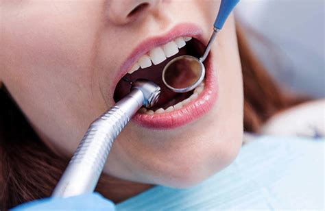 Profilaxia Dental O Que é E Quais São Os Seus Benefícios Invisalign