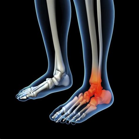 What Are The Causes Of Foot And Calf Pain Livestrongcom