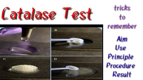 Catalase Test Tricks To Remember Youtube