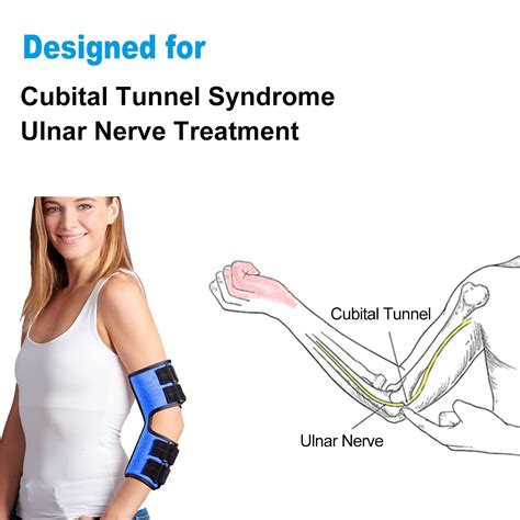 Buy Elbow Brace For Ulnar Nerve Entrapment Cubital Tunnel Syndrome