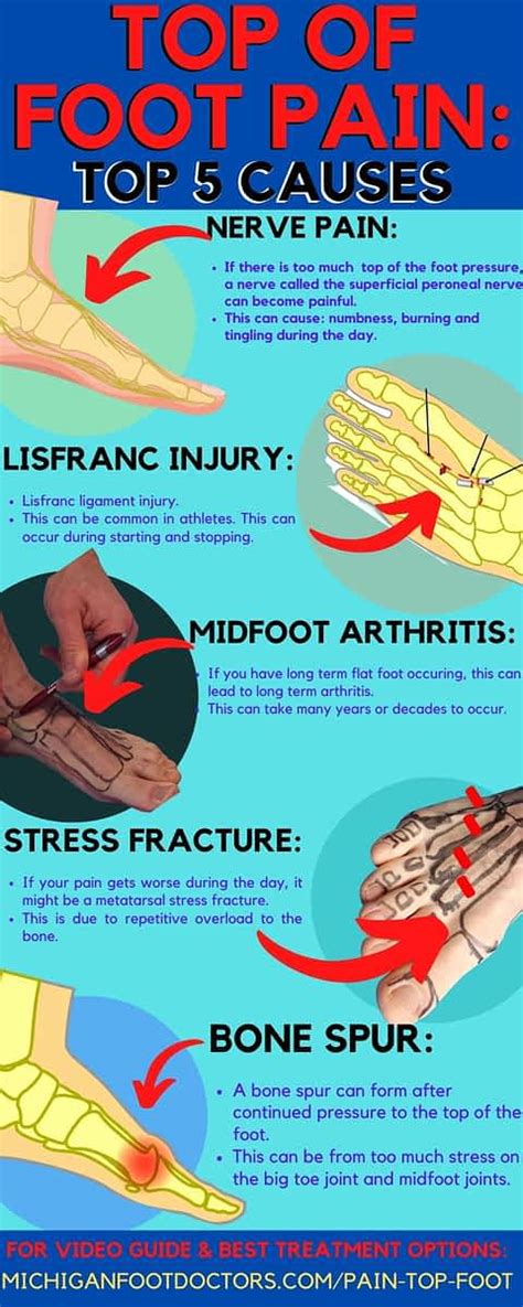 Top Of The Foot Arthritis Causes Symptoms And Best Treatment