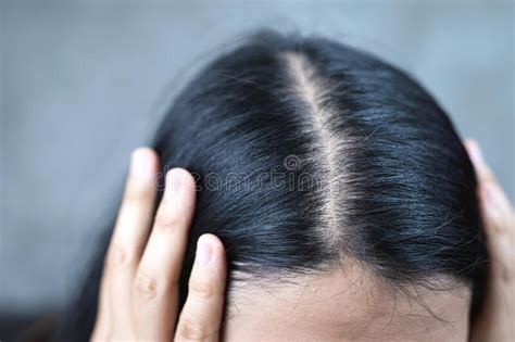 1315 Scalp Thinning Stock Photos Free And Royalty Free Stock Photos