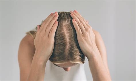 8 Ways To Tell If Youre Losing Too Much Hair