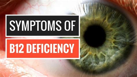 Signs Of Vitamin B12 Deficiency