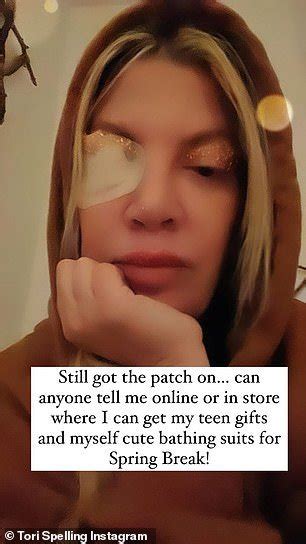 Tori Spelling I Kept Contact Lenses In For Days And Got A Horrific Ulcer Ny Breaking News